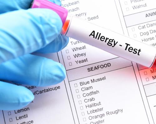 allergy testing